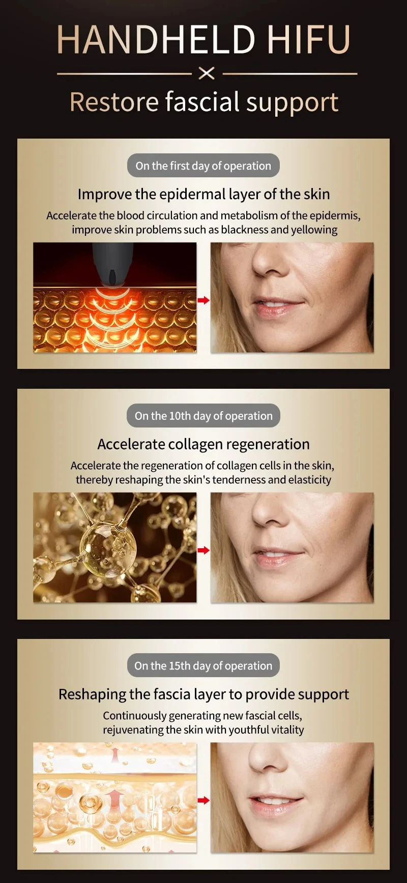 HIFU Face Lifting Device - Black Edition